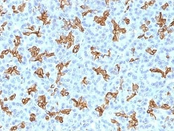 KRT19 / CK19 / Cytokeratin 19 Antibody (clone KRT19/800)