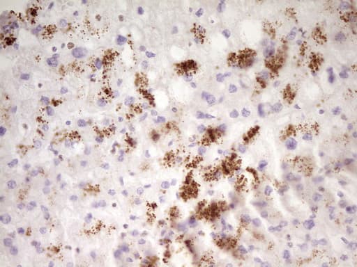 Monoclonal Mouse anti-Human SP110 Antibody (clone OTI4C1, aa232-521, IHC, WB)
