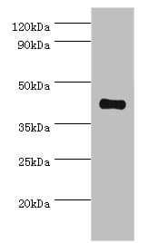 SSTR4 Antibody (aa314-388)