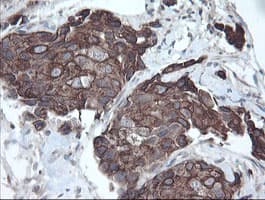 DPH2 Antibody (clone OTI2B12)