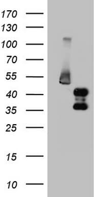 FOSB Antibody (aa1-255, clone OTI5H5)