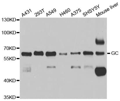 IHC-plus™ Polyclonal Rabbit anti-Human GC / Vitamin D-Binding Protein Antibody (IHC, IF, WB)