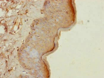 CEP57L1 Antibody