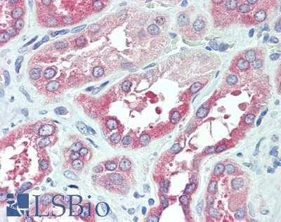 IHC-plus™ Polyclonal Rabbit anti-Human BAG3 / BAG-3 Antibody (aa300-350, IHC, WB)