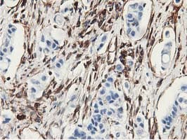 Latexin / MUM Antibody (clone OTI1E10)