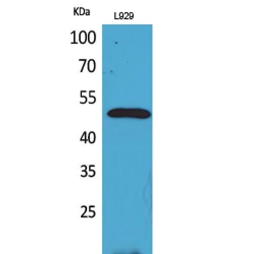 Polyclonal Rabbit anti-Human VEGFC Antibody (91-140 aa, Internal, IHC, WB)