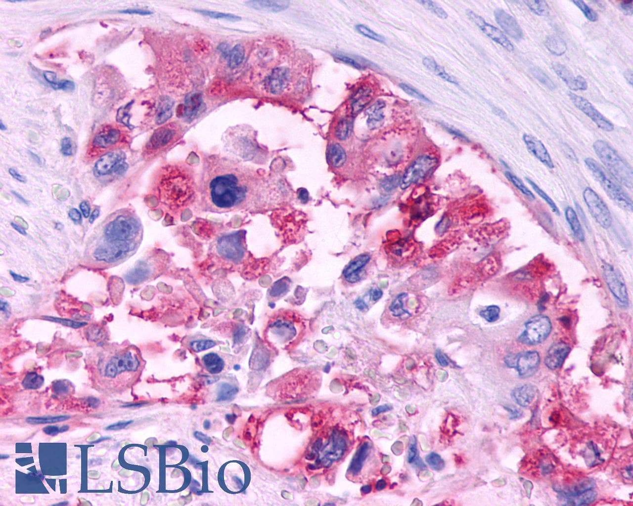 PathPlus™ CCR3 Antibody (Extracellular Domain)