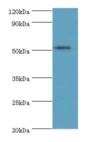 STARD3 / MLN64 Antibody (aa170-445)