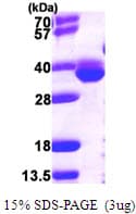 E. coli map/Methionine Aminopeptidase Protein (Recombinant His)