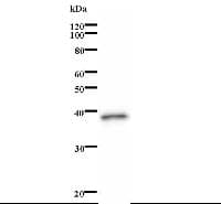 Monoclonal Mouse anti-Human NSD1 Antibody (clone 2658C1a, WB)