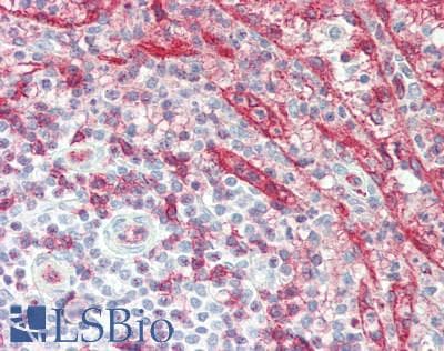 IHC-plus™ ICAM2 / CD102 Antibody (aa225-275)
