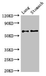 GAD65 Antibody