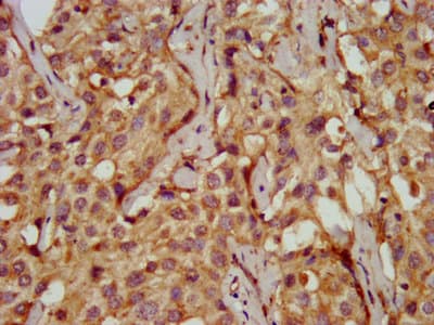 Polyclonal Rabbit anti-Human PDSS2 / DLP1 Antibody (IHC)