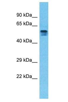 PDE4D Antibody (aa432-481)