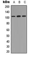 NFKB1 / NF-Kappa-B Antibody (C-Terminus)