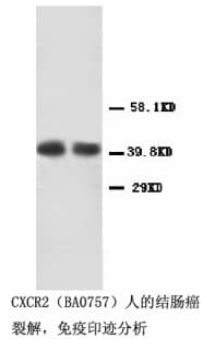 Polyclonal Rabbit anti-Human CXCR2 Antibody (Internal, WB)