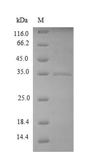 Bacillus subtilis YuaB Protein (Recombinant 6His-SUMO, N-terminus)