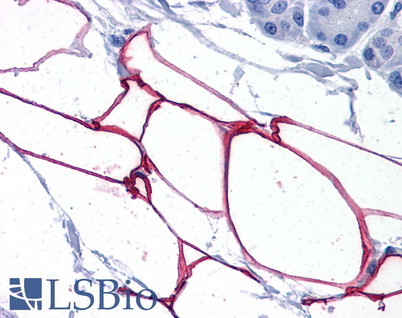 IHC-plus™ Polyclonal Goat anti-Human PLIN4 / S3-12 Antibody (aa1123-1138, IHC)