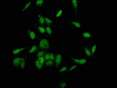 Polyclonal Rabbit anti-Human BRD4 Antibody (IF)
