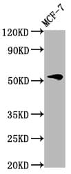 VTN / Vitronectin Antibody