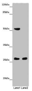 Polyclonal Rabbit anti-Human CHTOP / FOP Antibody (IHC, WB)