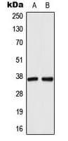 DDH / AKR1C1 Antibody (N-Terminus)
