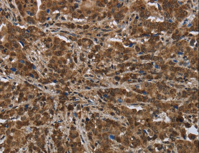 PIP / GCDFP-15 Antibody