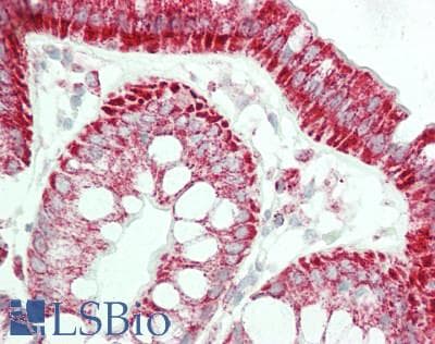 IHC-plus™ TSPO / PBR Antibody (C-Terminus)