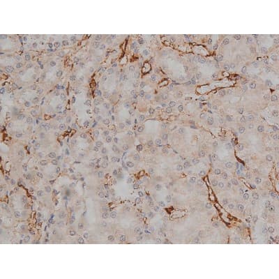 MAPT / Tau Antibody (phospho-Thr231)