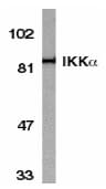 IHC-plus™ Polyclonal Rabbit anti-Human CHUK / IKKA / IKK Alpha Antibody (IHC, IF, WB)