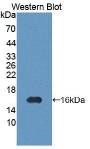 PIM1 / Pim-1 Antibody (aa122-261)