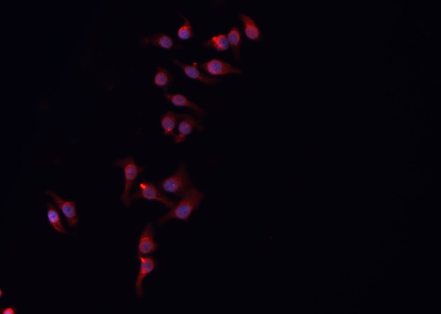 ARMCX3 Antibody