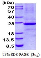 Human EFNB3 / Ephrin B3 Protein (Recombinant His)