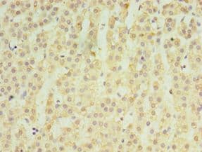MATN3 / Matrilin 3 Antibody (aa277-486)
