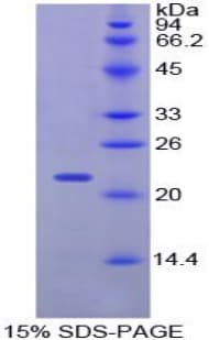 Chicken PTHLH / PTHRP Protein (Recombinant His-S)