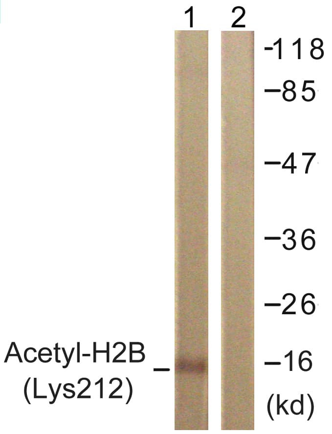 Histone H2B Antibody (Acetyl-Lys12)
