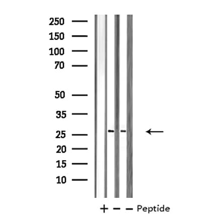PRX-1 / PRRX1 Antibody