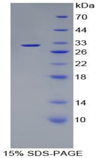 Rat KLK1 / Kallikrein 1 Protein (Recombinant 6His, N-terminus)