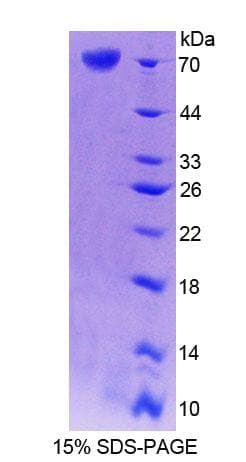 Mouse CRTAP Protein (Recombinant His-GST)