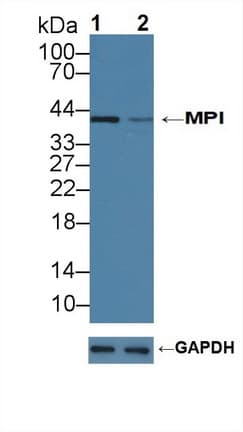 Polyclonal Rabbit anti-Human Mannose Phosphate Isomerase Antibody (aa2-423, WB)