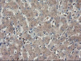 TDO2 Antibody (clone OTI2A4)