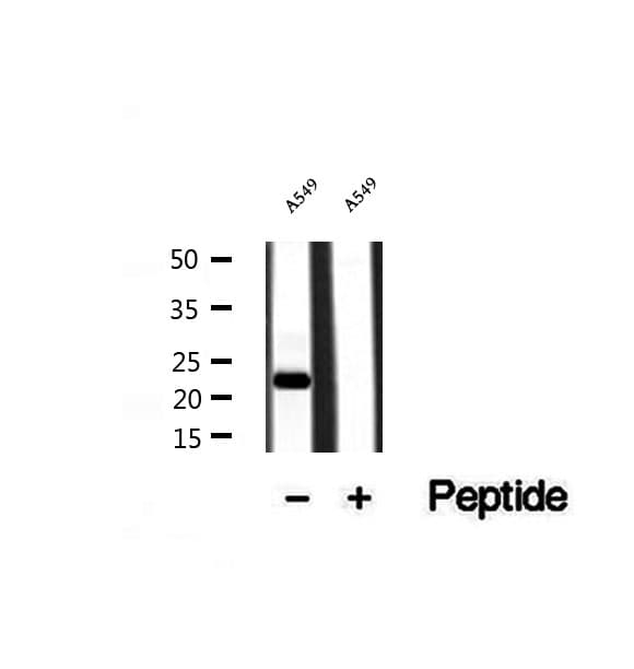 Polyclonal Rabbit anti-Human DESI2 / PPPDE1 Antibody (IHC, WB)