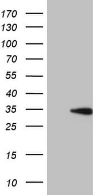 CCND2 / Cyclin D2 Antibody (clone OTI1C8)