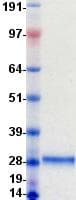 Mouse PS20 / WFDC1 Protein (Recombinant His-DDK (Flag), N-terminus)