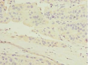 Polyclonal Rabbit anti-Human MGLL / Monoacylglycerol Lipase Antibody (IHC)