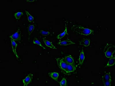 KCNIP4 / KCHIP4 Antibody
