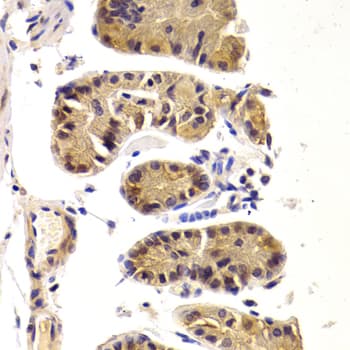 Polyclonal Rabbit anti-Human DDX3 / DDX3X Antibody (IHC, IF, WB)