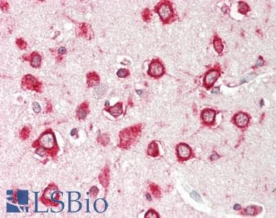 IHC-plus™ RPL5 / Ribosomal Protein L5 Antibody (aa247-297)