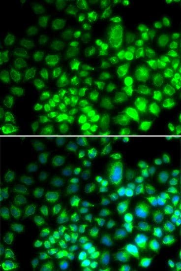 ST6GAL1 / CD75 Antibody