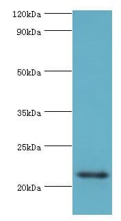 Polyclonal Rabbit anti-Human HSPB8 / H11 / HSP22 Antibody (aa1-196, WB)